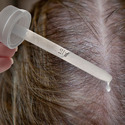 Hair Loss Treatment Services